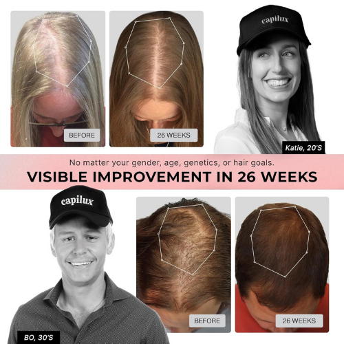 Capilux™ Hair Growth Cap